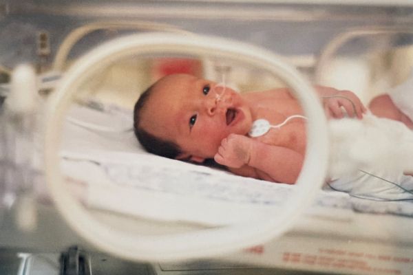 A premature baby in the hospital