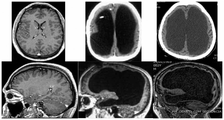 Fake adaptation from Feuillet et al. 2007 that DRF unknowingly uploaded