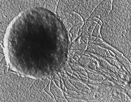 Methanococcus jannischii, an archaebacterium (a prokaryote of the group archaea).