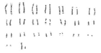 Chromosomes