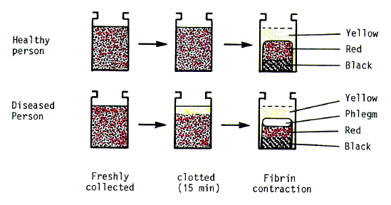 entrop06.gif (100862 bytes)