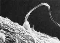 Spermatozoan at surface of ovum
