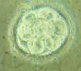 Zygote divides to produce a multicelled blastula
