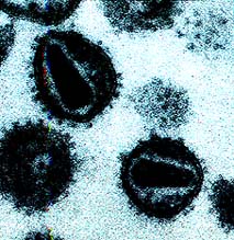 Diploid HIV-1 virus particles. Two RNA genomes come together for packaging. This process is analogous to meiosis in that there is a homology search and "kissing" interactions between the tips of stem-loops in the "encapsidation site". Unlike meiosis there may be no flexibility in choice of site for pairing interaction.