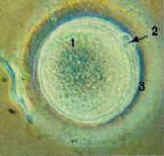 ovum prior to fertilization showing polar bodies and zona pellucida