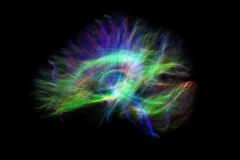 Diffusion Spectrum Imaging (DSI) of neuron connections in a brain captured during Queen's research
