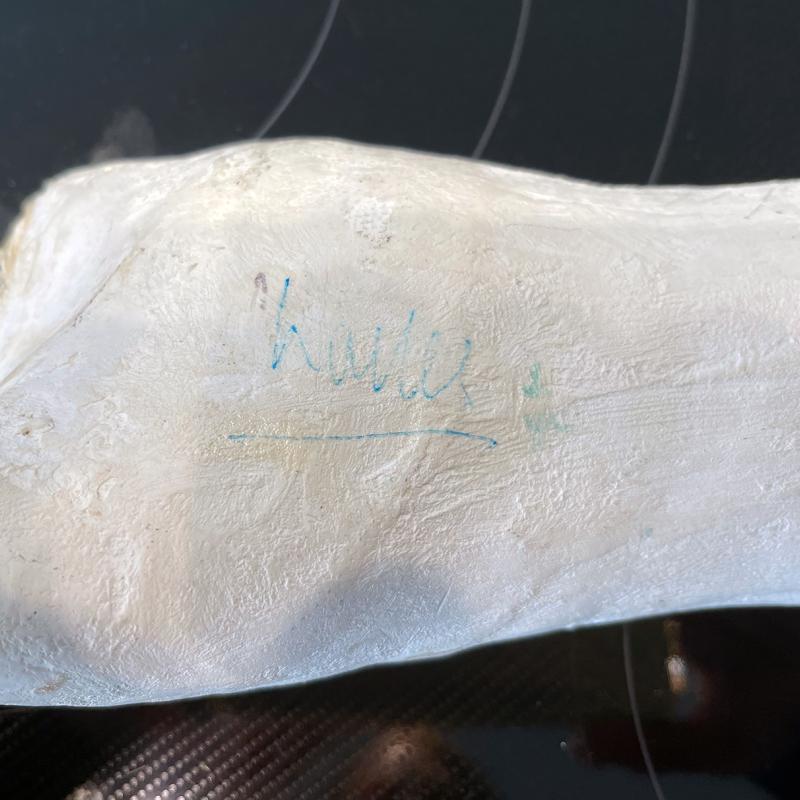 Close-up of Prince Charles' signature on an arm cast, October 1991.