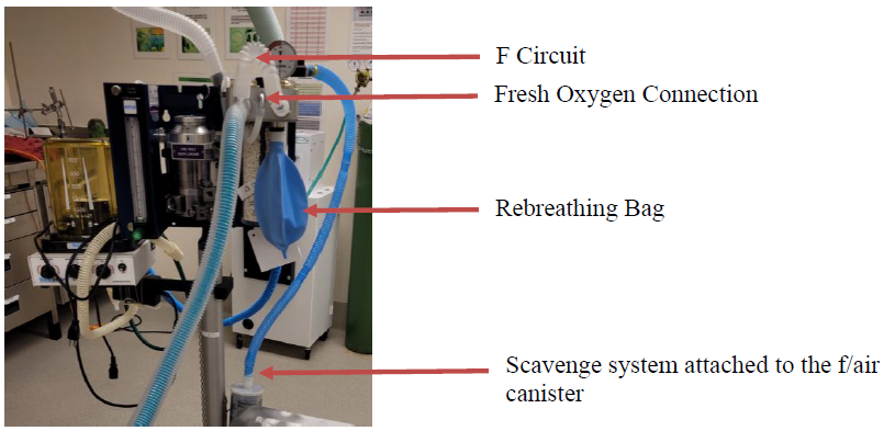 Image showing Anesthetic Machine Setup