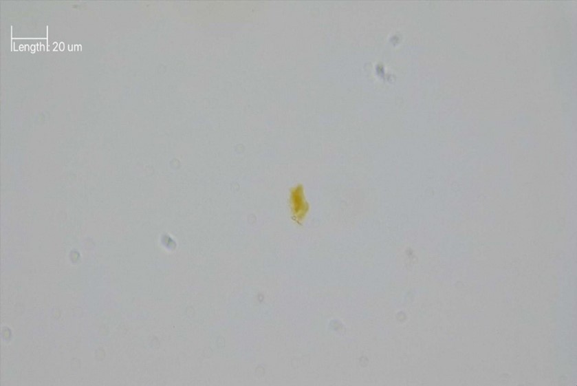 Yellow particle in PLM