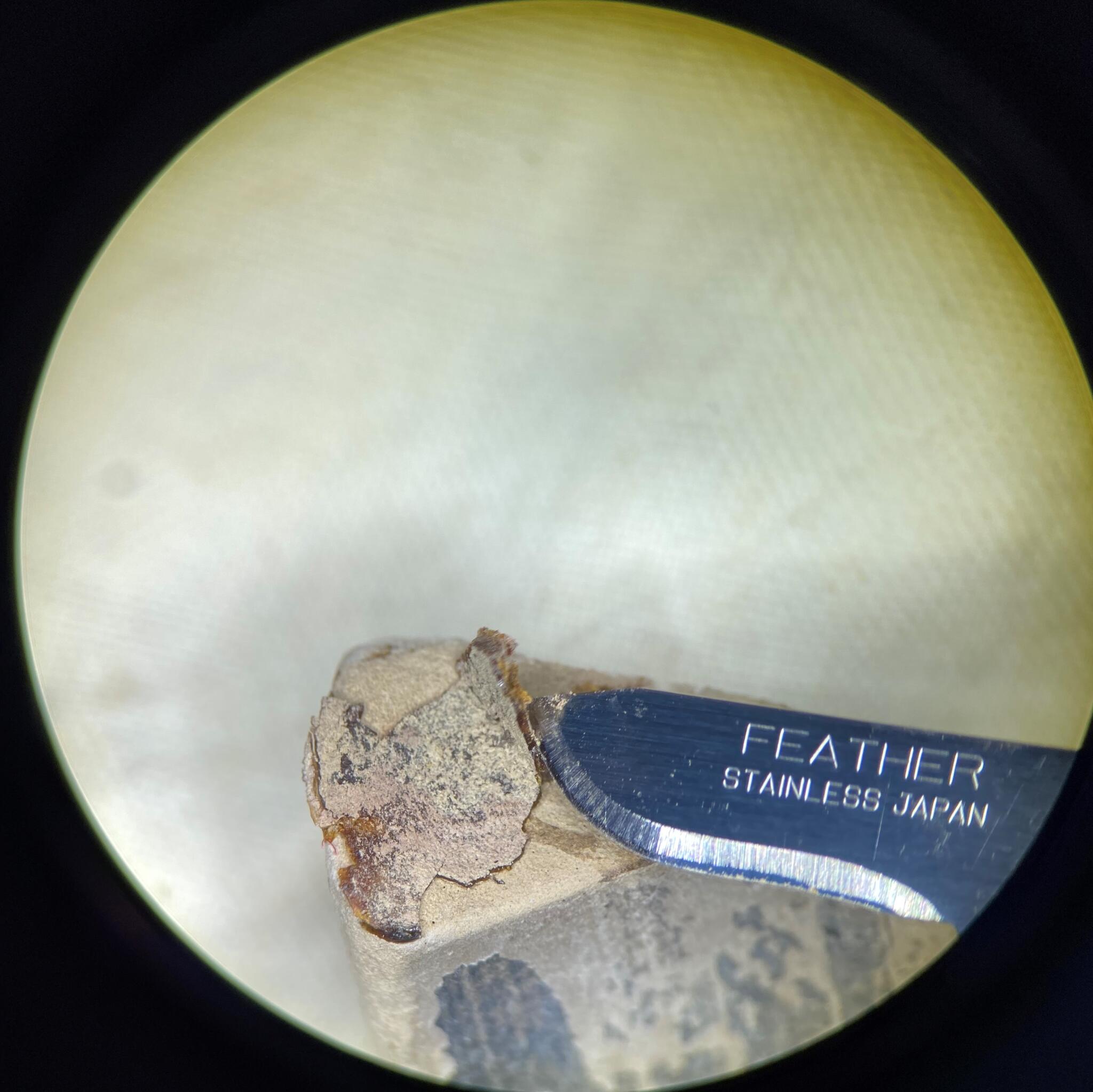 Removing shellac with scalpel from lekythos DC 14