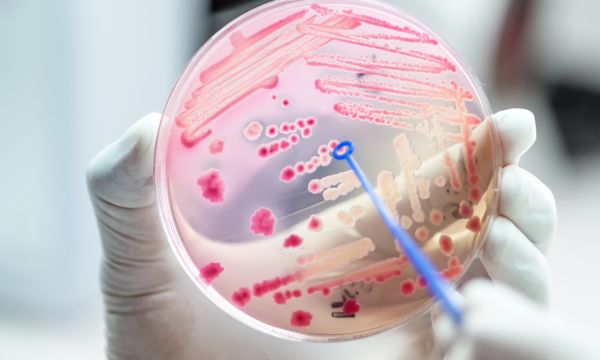 Petri dish with bacteria shown in it