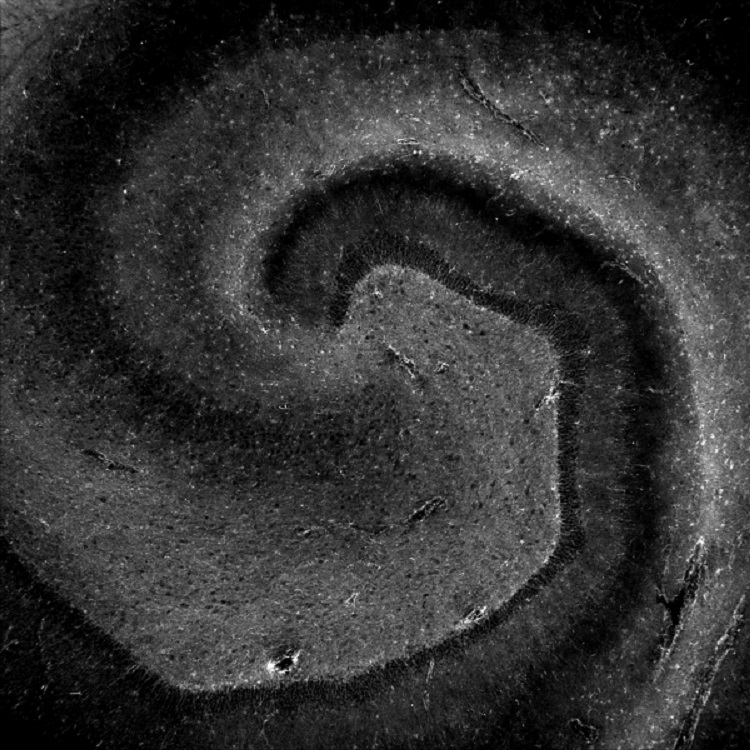 Microscopic photo capturing cells within the hippocampus,