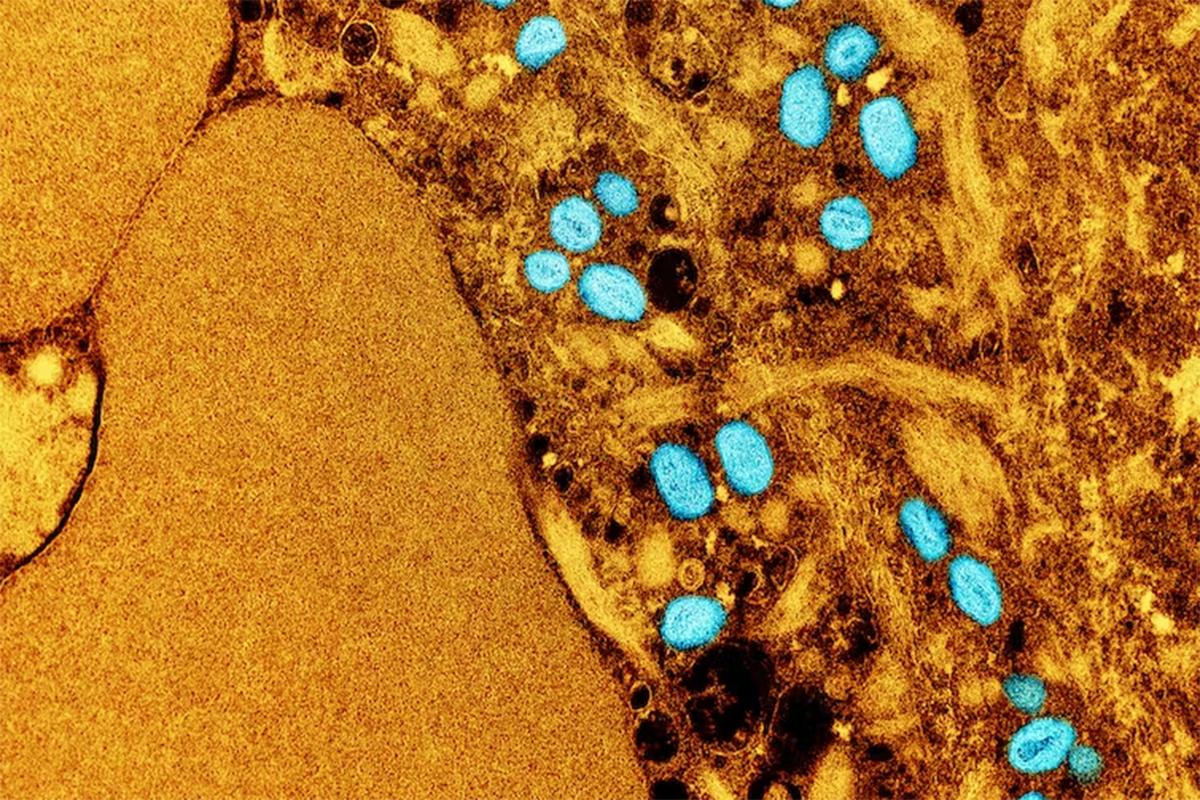 Monkeypox is transmitted mainly through direct contact with skin lesions, but the current outbreak is following patterns similar to STIs. (NIAID, cropped from original), CC BY