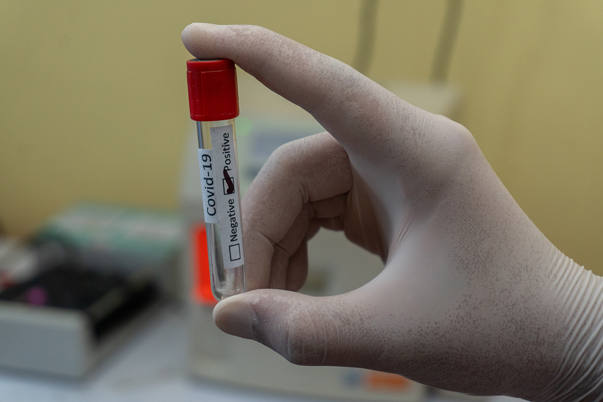 A lab technician handles a specimen that has tested positive for COVID-19