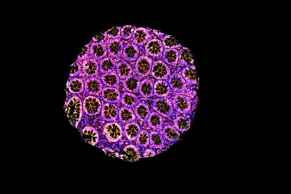 [Art of Research photo: Immunofluorescence Stain]