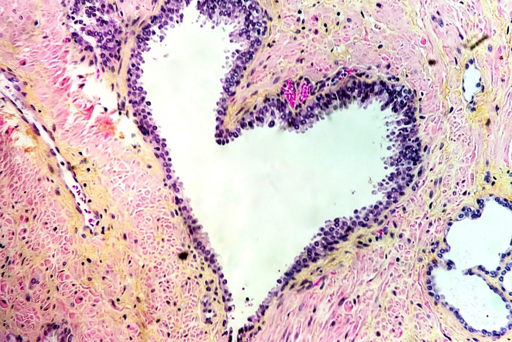 “Love Under the Microscope.” Dalila Villalobos, Pathology Researcher. Submitted to the Art of Research.