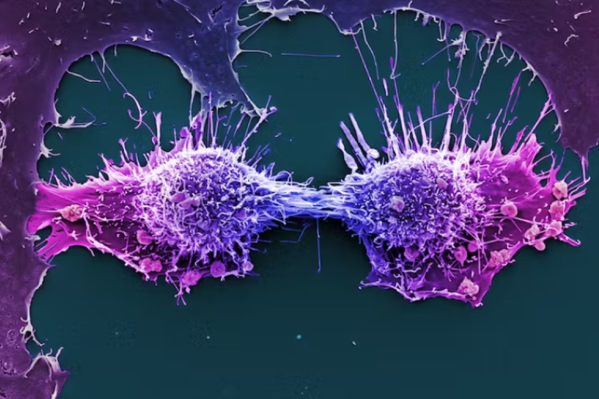 The HeLa line of immortal human epithelial cancer cells was derived from cells taken from Henrietta Lacks when she was a cancer patient in 1951. (Wellcome Collection: Anne Weston, Francis Crick Institute), CC BY-NC