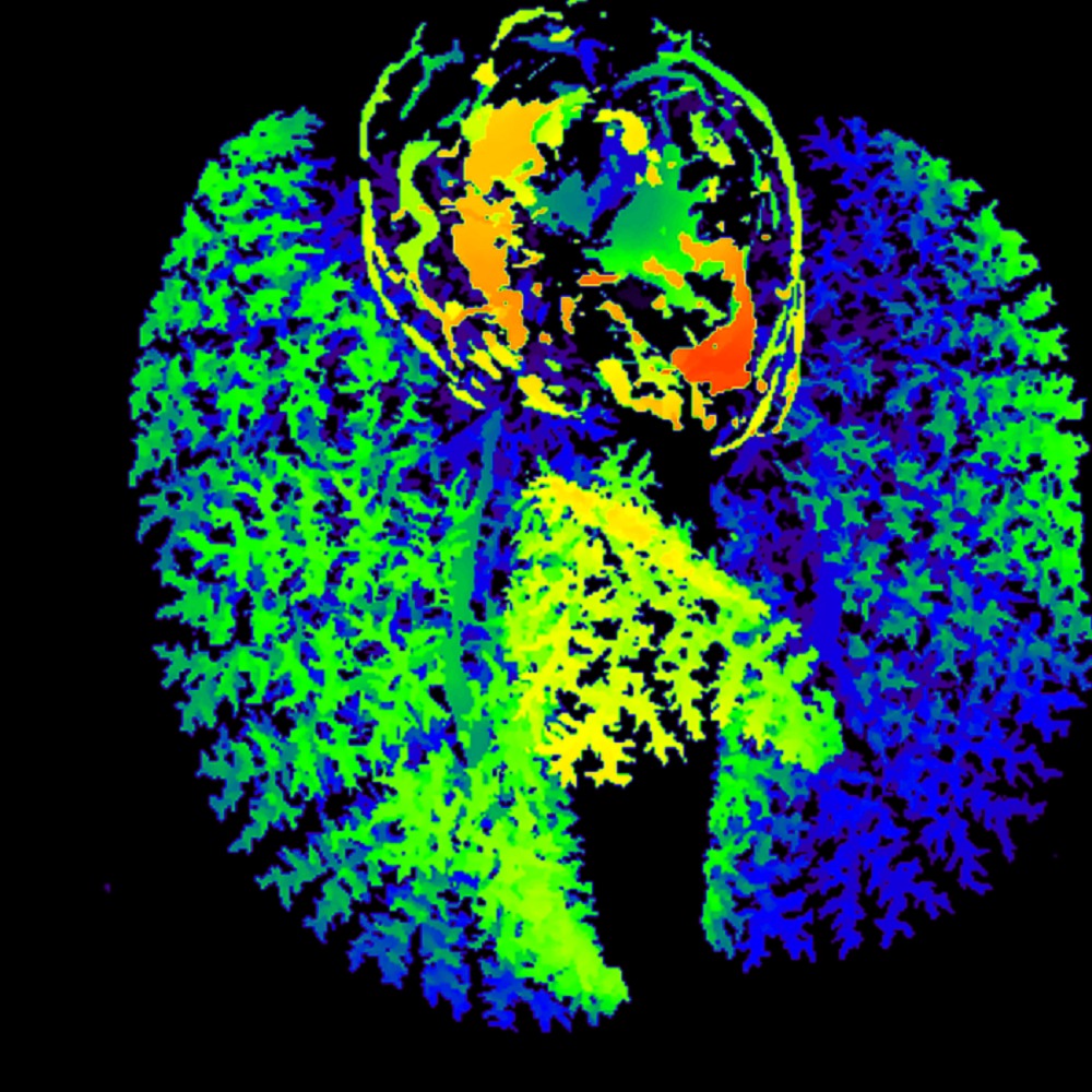 [Photo of 3D vascular trees in animal models]