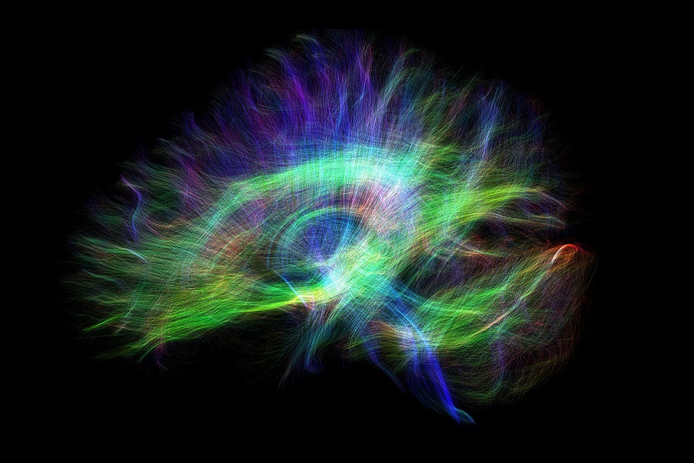 [Photo of a MRI of a brain by Donald Brien]