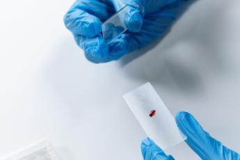 A lab technician wearing blue gloves handles a blood sample on a slide.