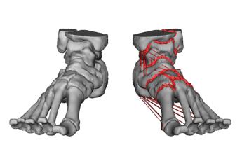 [Rendering of the bones and ligament attachment points of the foot]