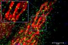 Red mitochondria in airway cells become coated with green SARS-COV-2 proteins after viral infection: Researchers discovered that the virus that causes COVID-19 damages lungs by attacking mitochondria.
