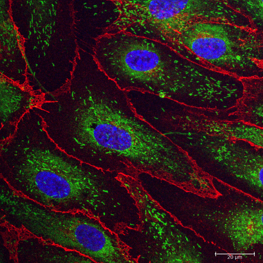 Confocal images of endothelial colony forming cells