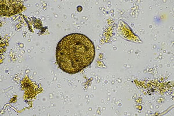 Genome Prairie: BENEFIT; How soil microbes hold a key in reducing greenhouse gas emissions