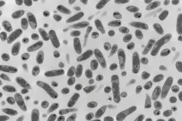 Looking back and moving ahead on microbial inoculants: Part Two