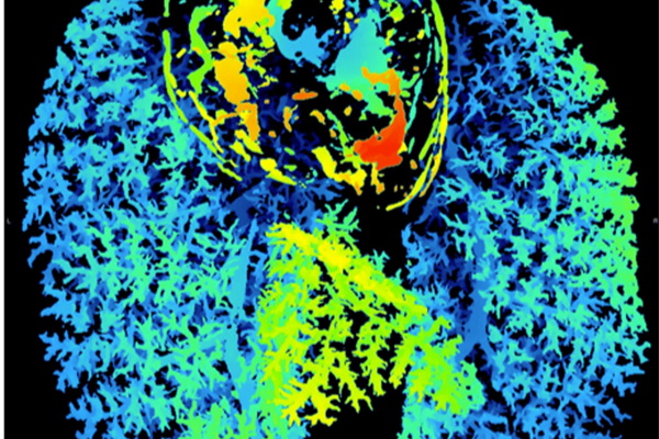 Cardio-pulomary dye imaging