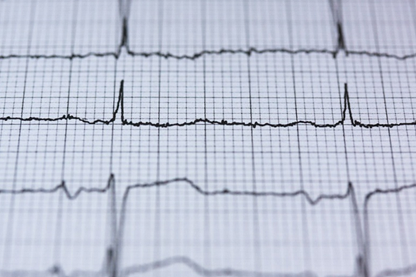 Analog heartbeat on graph paper
