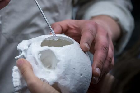 Biopsy capsule attached to Fraizer suction demonstrates collection of a biopsy sample on a model skull 
