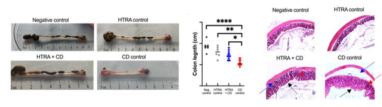 Left photo showing colons from lab mice groups demonstrating colonic and cecum shortening. Middle image shows graph indicating colon length from each mouse measured in cm demonstrates that CD control mice had significantly more colonic shortening than all other groups. Right image shows H&E staining of distal colons from each group of mice demonstrating edema (blue arrow), epithelial damage (black arrow0 and cellular infiltration (red arrow). 