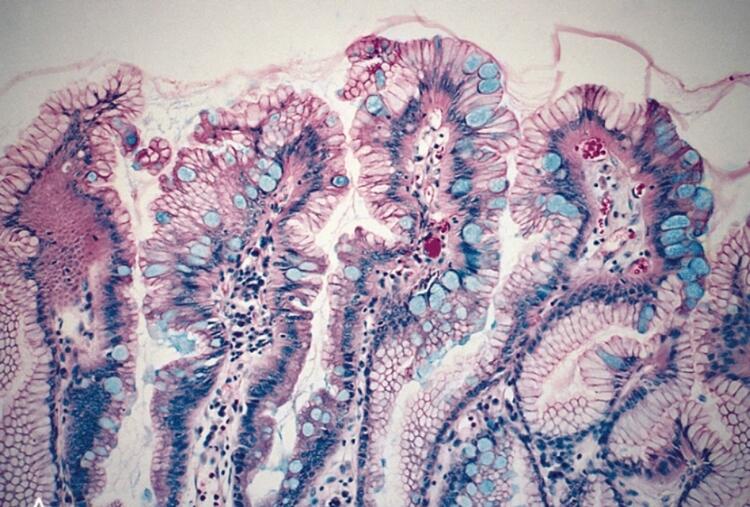 Cross-section of tissue sample