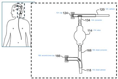 Figure drawing of the shunt system