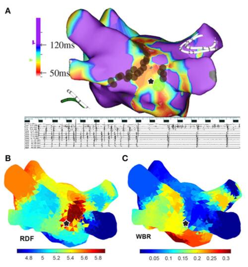 3d atrial maps
