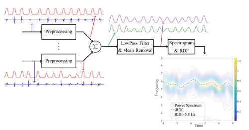 Block diagram of the proposed method for the regional dominant frequency (RDF) analysis and sample output of each stage.
