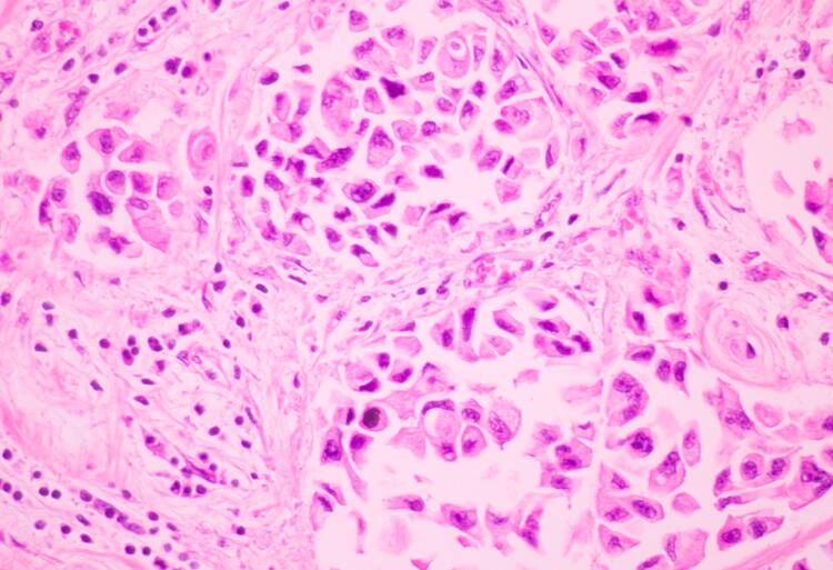 Epithelial cells under stained pink microscope