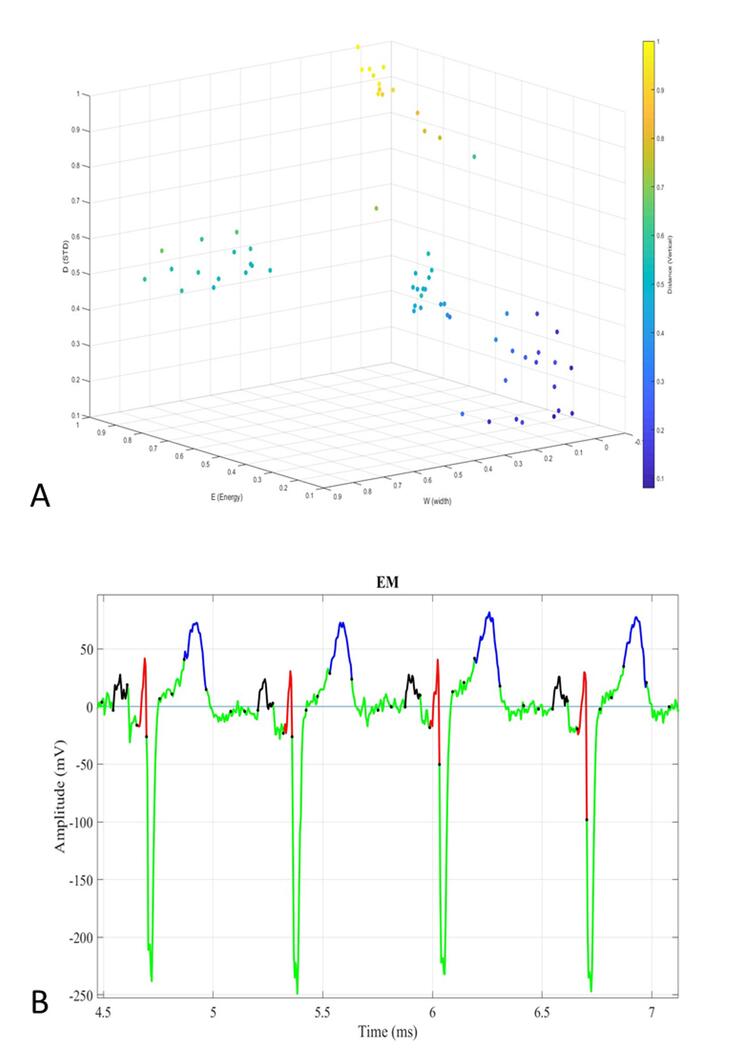 The ECG segmentation results for a typical ECG in (a) feature space and (b) time domain. 