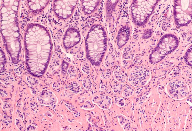 Stained endocrine cells