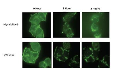 Micrscopic view of MycB disrupting the actin cytoskeleton