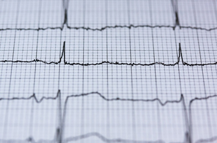 Analog heartbeat on graph paper