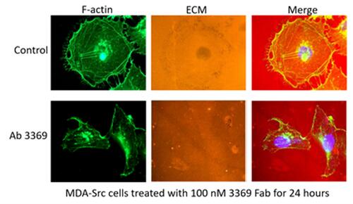 MDA-Src cells seeded on TRITC-gelatin-coated coverslips