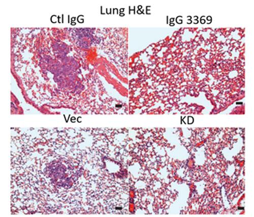 Lung tissue sections from MDA-MB-231 tumor-bearing mice. 