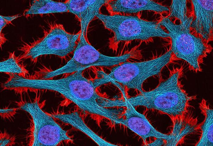 Cancer cell illustration