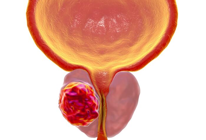 Prostate cross-section