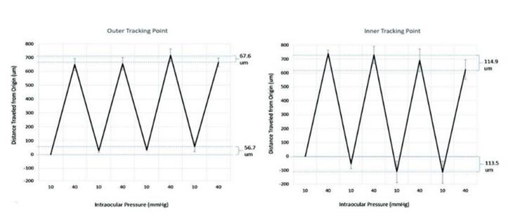 Two charts showing the fluctuations of intraocular pressure data