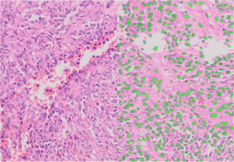 Nuclear Segmentation