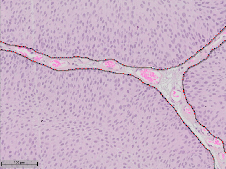 Tissue Classification