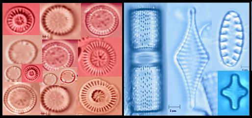  Assortment of diatoms